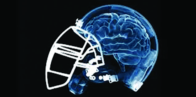 What the new CTE test results mean for the future of the NFL