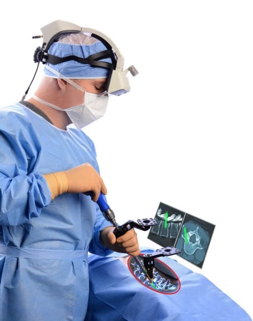 Hospitals launch groundbreaking AR-guided spine surgery program