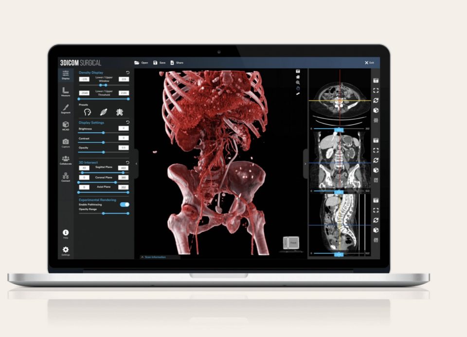 CG1 Solutions selected to market 3Dicom in U.S.