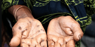 Arsenic contamination of food and water is a global public health concern – researchers are studying how it causes cancer