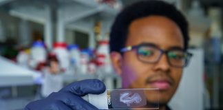 Biomarker could detect Alzheimer’s years before symptoms appear, study finds